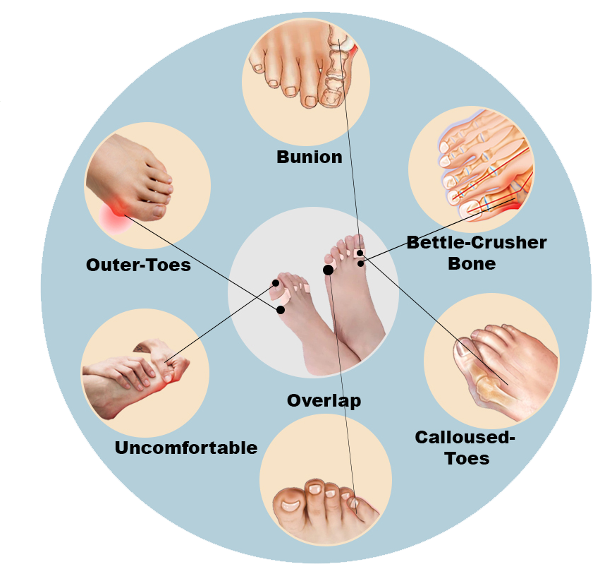 Orthopedic Feet Shaper Adjuster Bone Foot Care