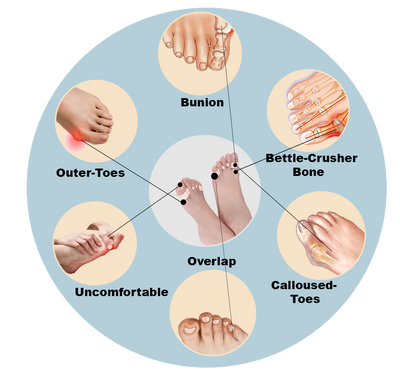 Orthopedic Feet Shaper Adjuster Bone Foot Care