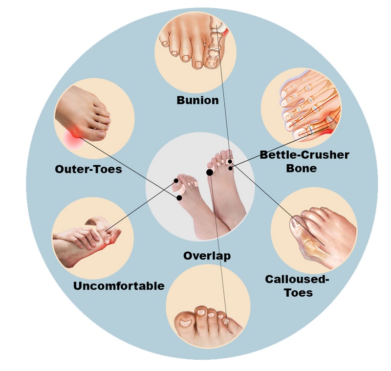 Orthopedic Feet Shaper Adjuster Bone Foot Care