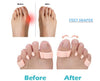 Orthopedic Feet Shaper Adjuster Bone Foot Care